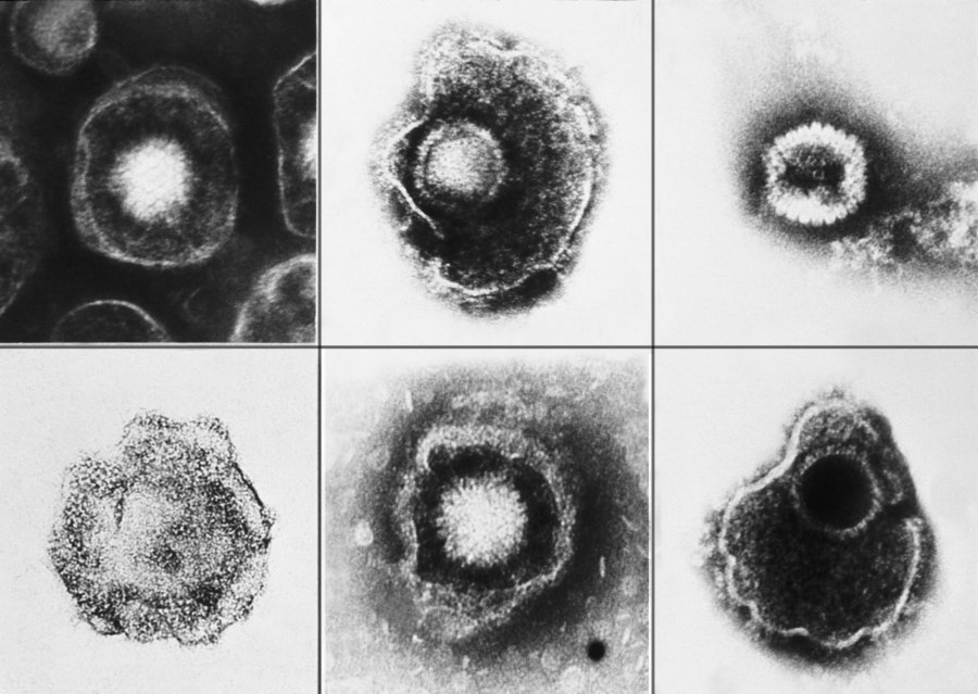 Sexually Transmitted Infection Research Interest Group STIRIG